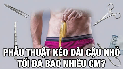 Phẫu thuật kéo dài cậu nhỏ tối đa bao nhiêu cm là cao nhất
